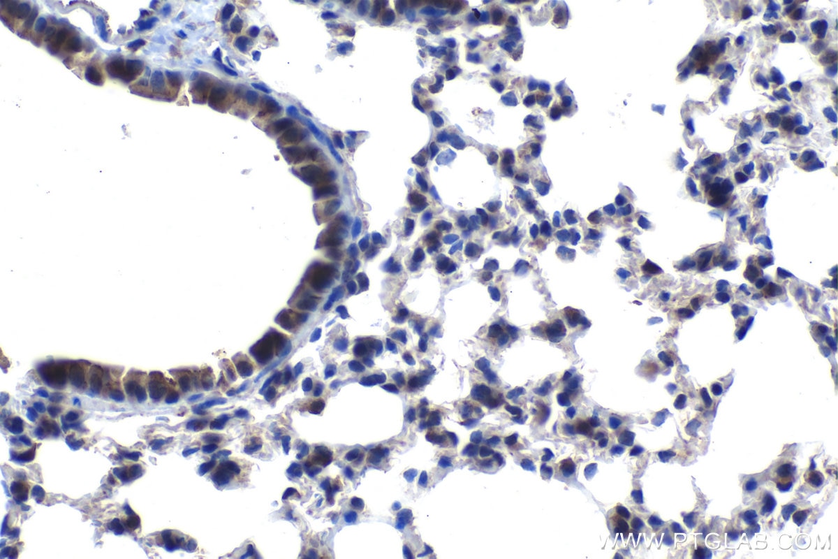Immunohistochemical analysis of paraffin-embedded mouse lung tissue slide using KHC1154 (TIMP2 IHC Kit).