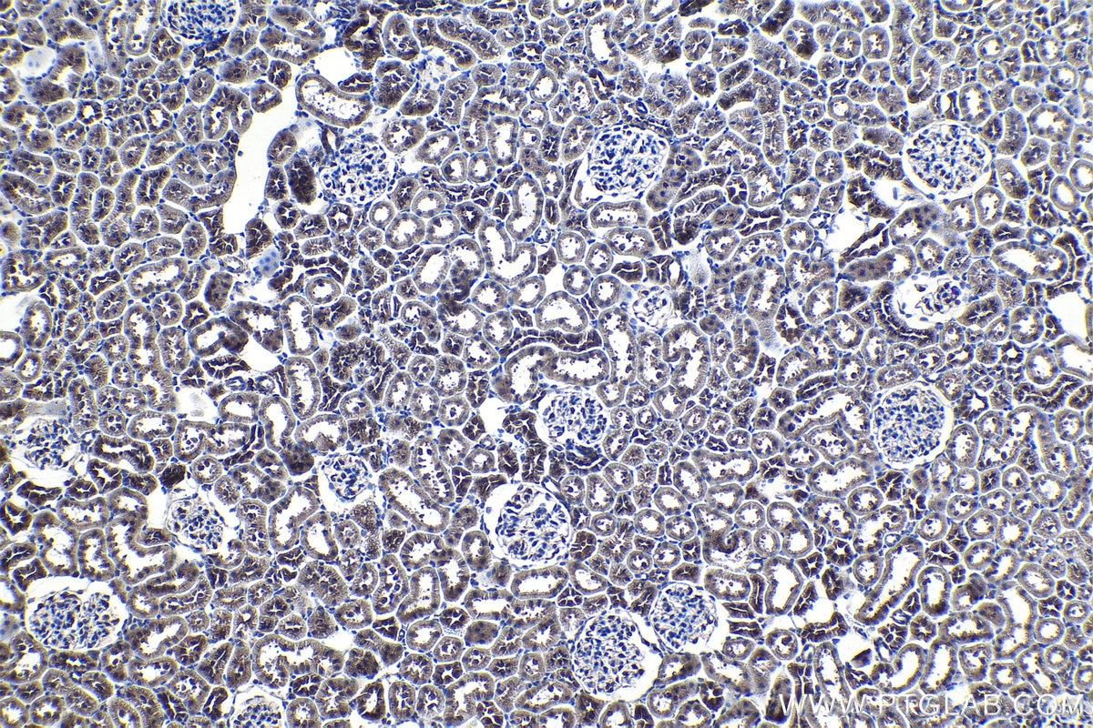 Immunohistochemical analysis of paraffin-embedded rat kidney tissue slide using KHC1154 (TIMP2 IHC Kit).