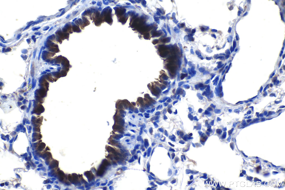 Immunohistochemical analysis of paraffin-embedded rat lung tissue slide using KHC1154 (TIMP2 IHC Kit).