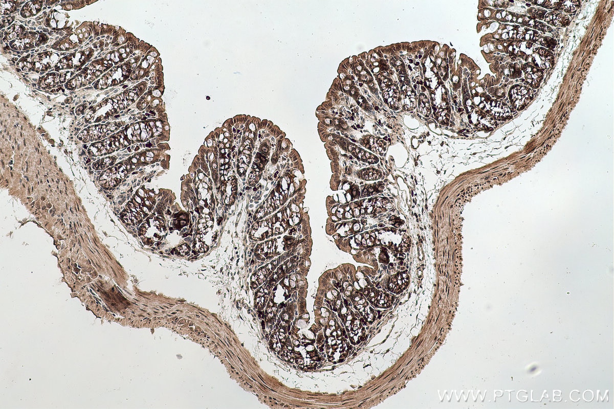 Immunohistochemical analysis of paraffin-embedded mouse colon tissue slide using KHC0765 (TK1 IHC Kit).