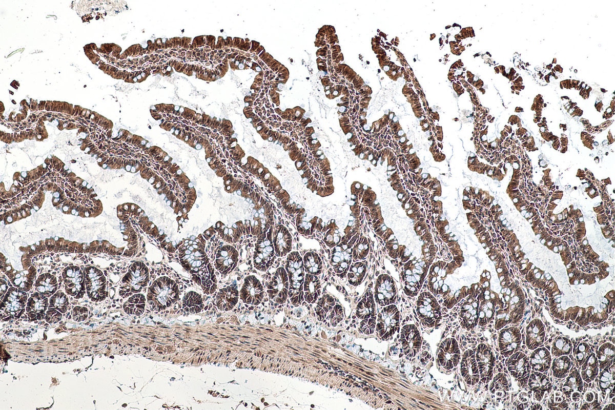 Immunohistochemical analysis of paraffin-embedded rat colon tissue slide using KHC0765 (TK1 IHC Kit).