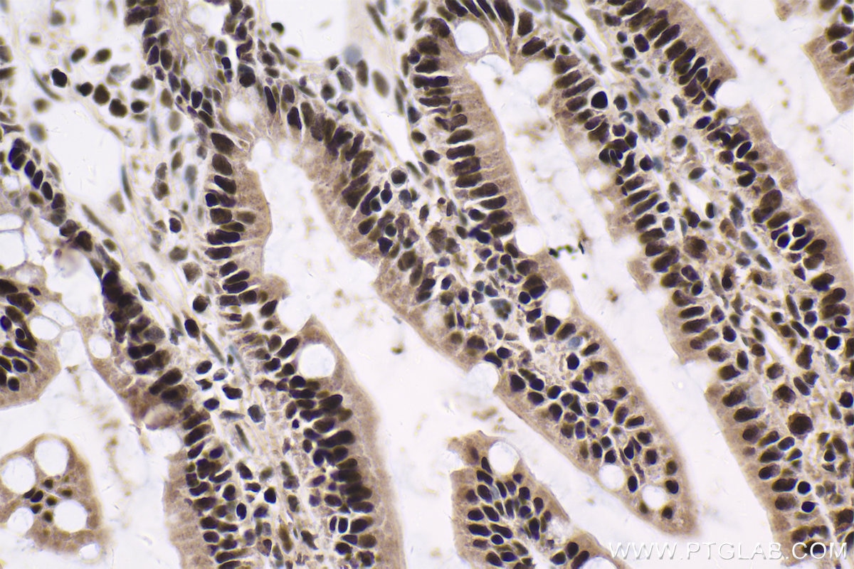 Immunohistochemical analysis of paraffin-embedded rat small intestine tissue slide using KHC1673 (TLE3 IHC Kit).