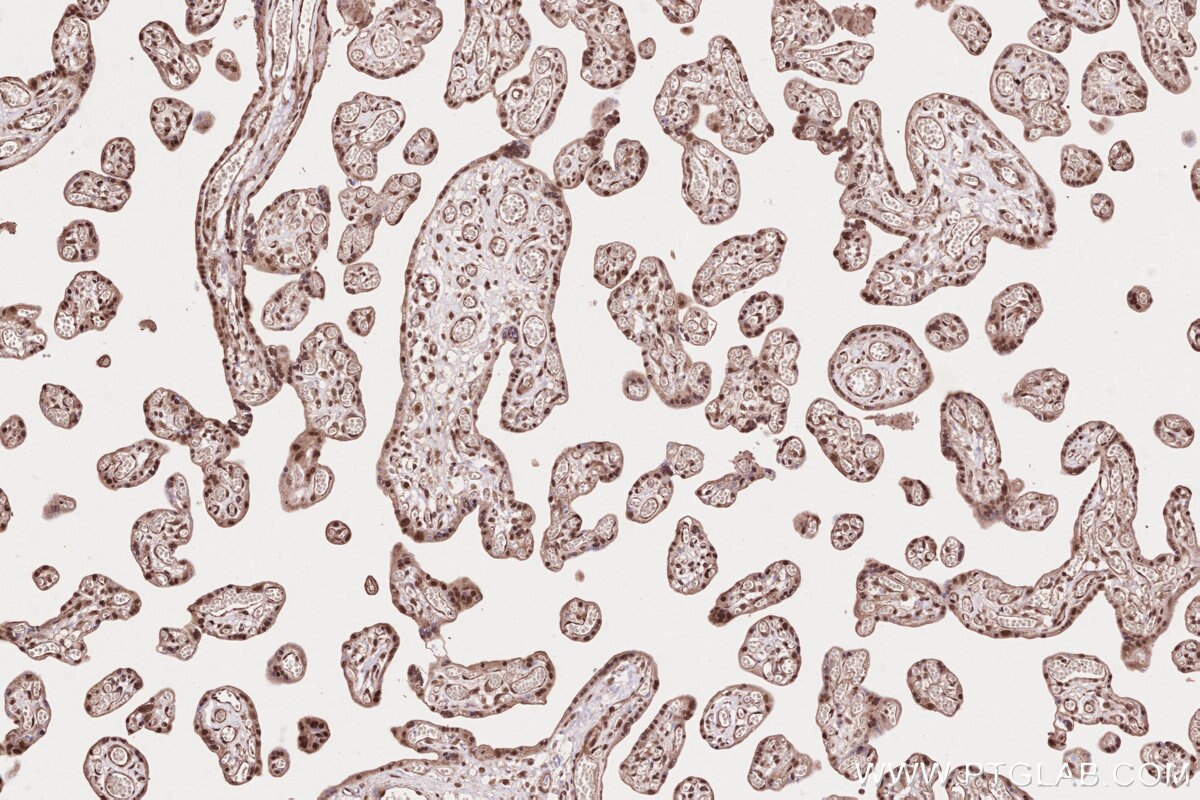 Immunohistochemical analysis of paraffin-embedded human placenta tissue slide using KHC2634 (TLK2 IHC Kit).
