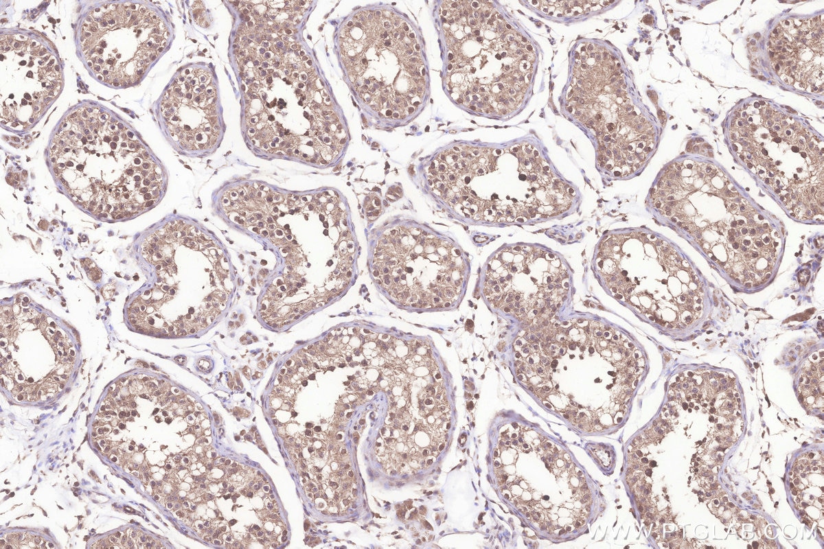 Immunohistochemical analysis of paraffin-embedded human testis tissue slide using KHC3230 (TMBIM6 IHC Kit).