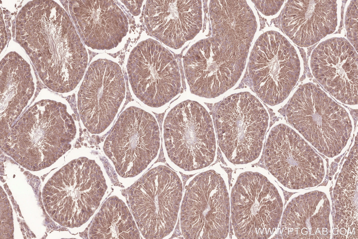 Immunohistochemical analysis of paraffin-embedded rat testis tissue slide using KHC3230 (TMBIM6 IHC Kit).