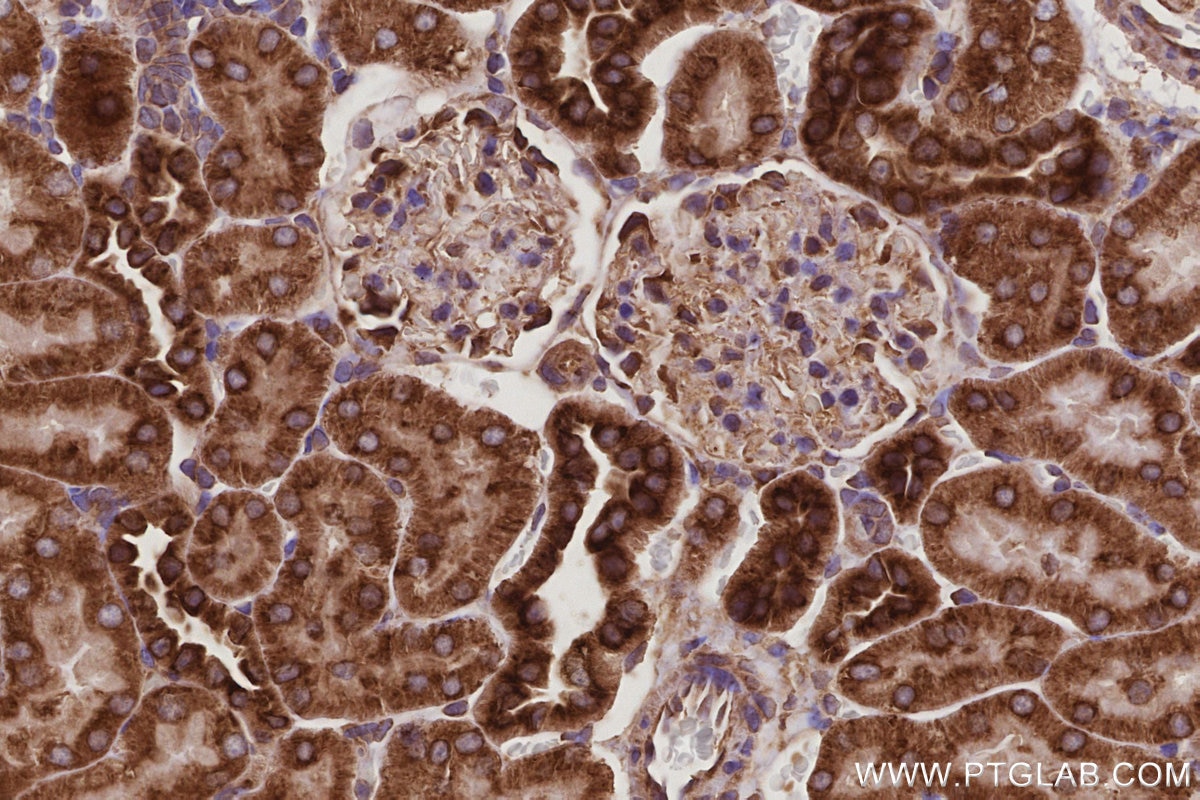 Immunohistochemical analysis of paraffin-embedded rat kidney tissue slide using KHC2984 (TMEM111 IHC Kit).