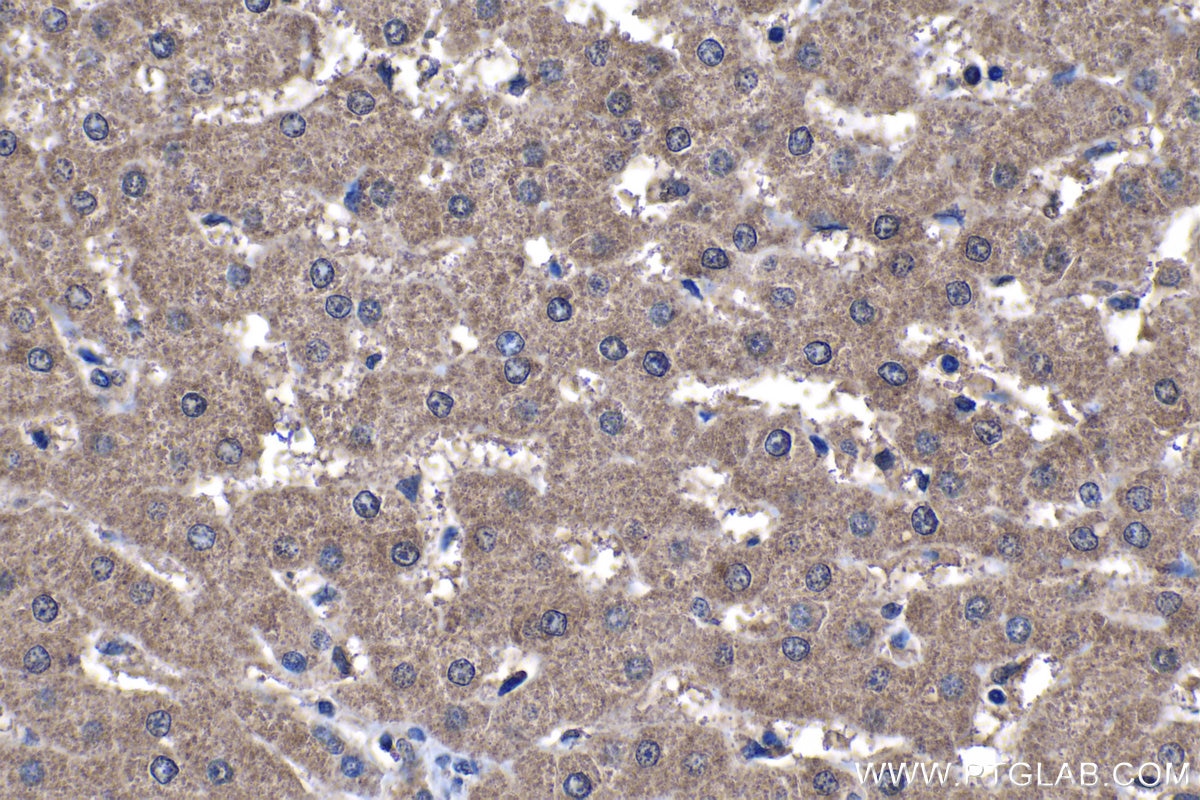 Immunohistochemical analysis of paraffin-embedded human liver tissue slide using KHC1198 (TMEM25 IHC Kit).