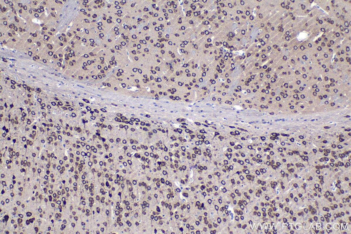 Immunohistochemical analysis of paraffin-embedded mouse brain tissue slide using KHC1289 (TMEM38A IHC Kit).