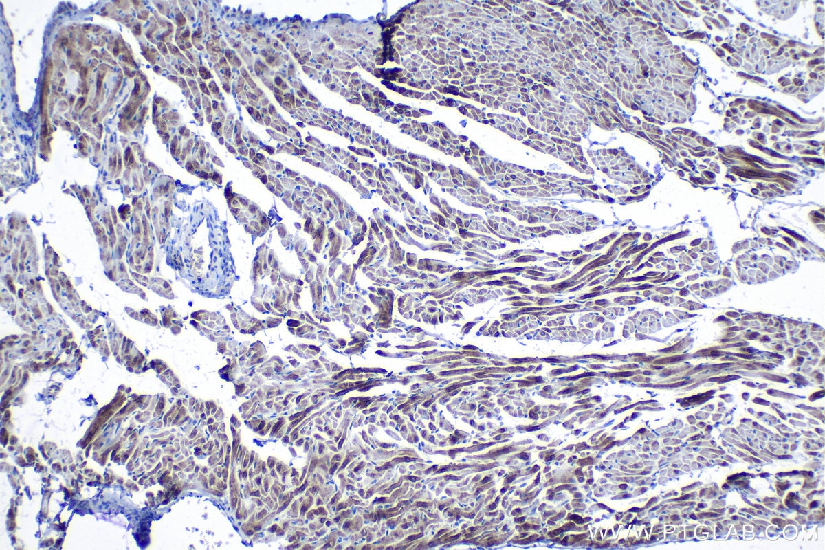 Immunohistochemical analysis of paraffin-embedded rat heart tissue slide using KHC1289 (TMEM38A IHC Kit).