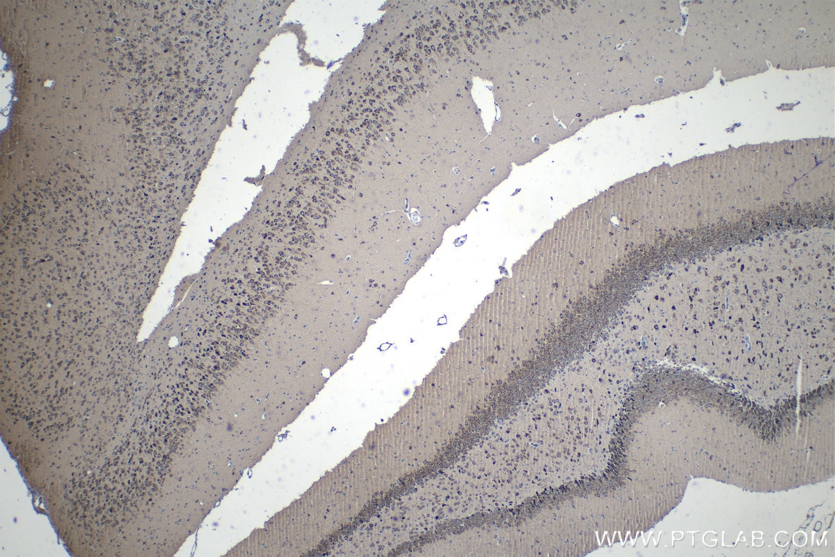 Immunohistochemical analysis of paraffin-embedded rat brain tissue slide using KHC1289 (TMEM38A IHC Kit).