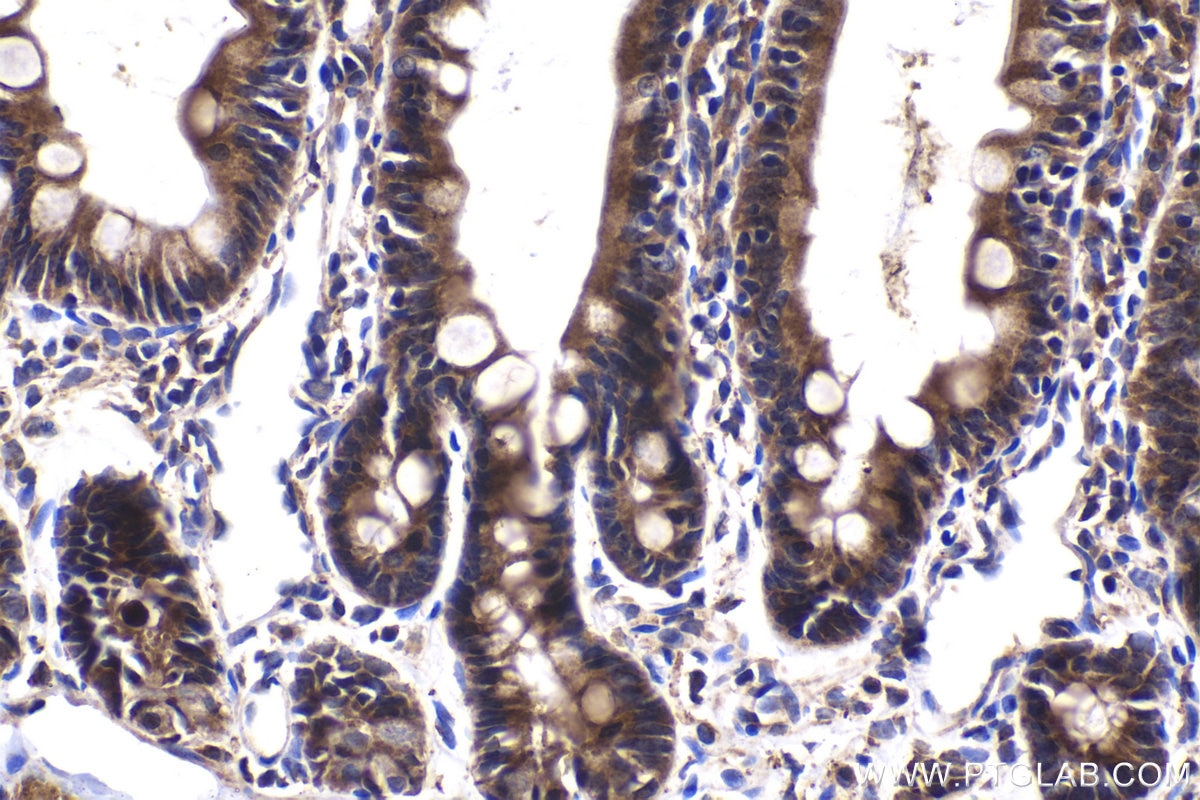 Immunohistochemical analysis of paraffin-embedded rat small intestine tissue slide using KHC2039 (TMEM8B/NGX6 IHC Kit).