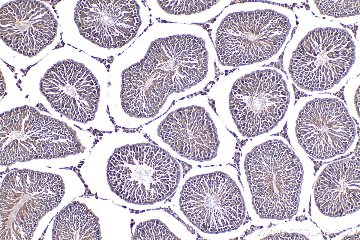 Immunohistochemical analysis of paraffin-embedded rat testis tissue slide using KHC2039 (TMEM8B/NGX6 IHC Kit).