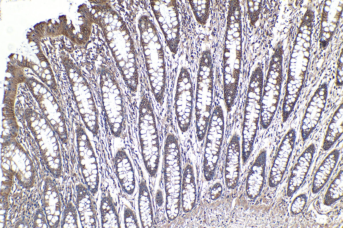 Immunohistochemical analysis of paraffin-embedded human colon tissue slide using KHC1244 (TMOD3 IHC Kit).