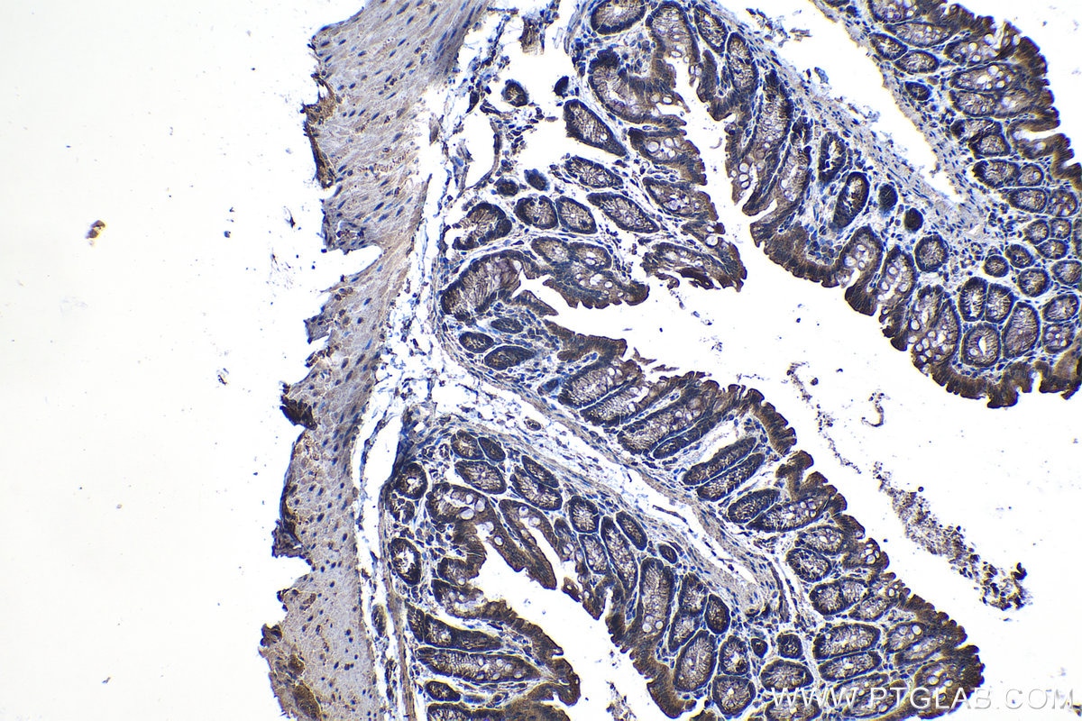 Immunohistochemical analysis of paraffin-embedded mouse colon tissue slide using KHC1244 (TMOD3 IHC Kit).