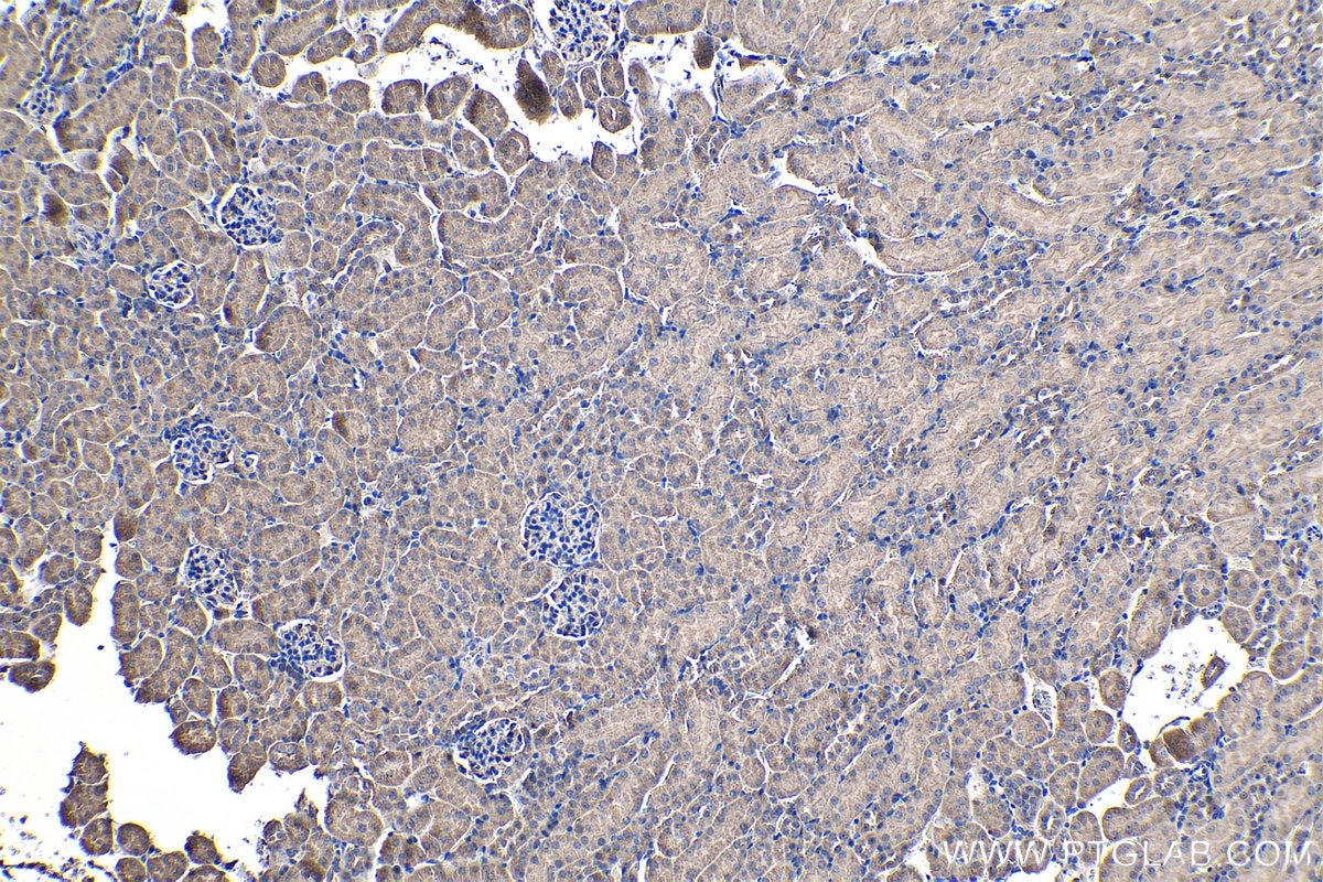 Immunohistochemical analysis of paraffin-embedded mouse kidney tissue slide using KHC1244 (TMOD3 IHC Kit).