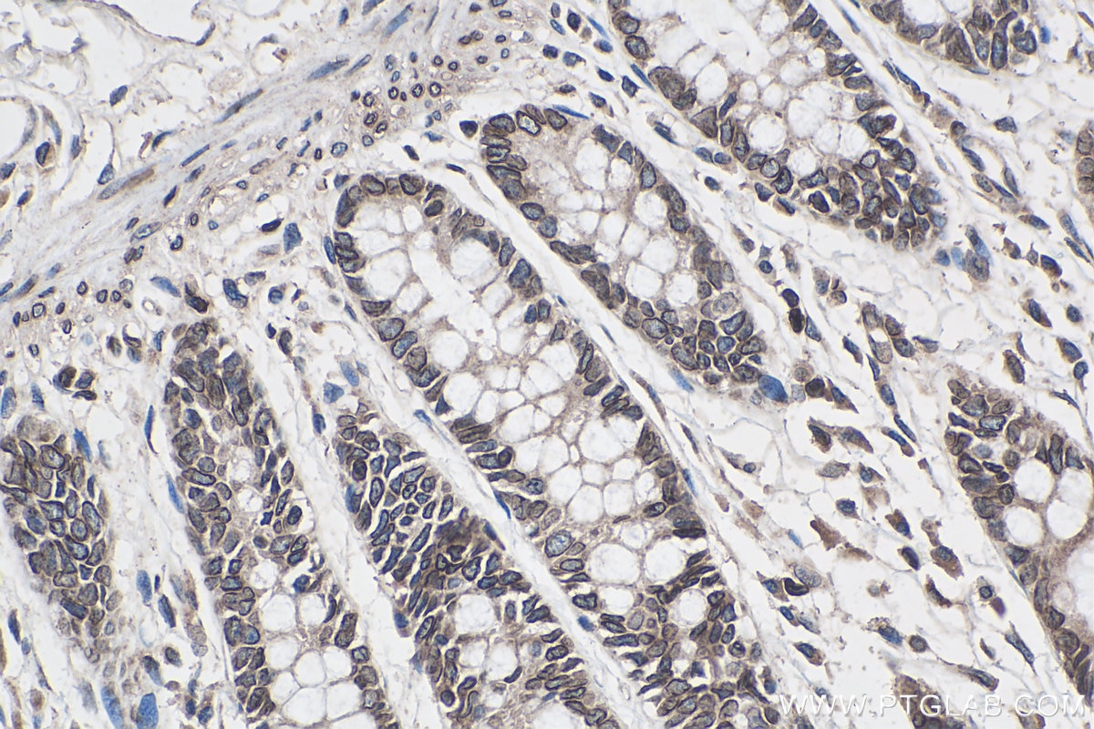Immunohistochemical analysis of paraffin-embedded human colon tissue slide using KHC0317 (TMPO IHC Kit).