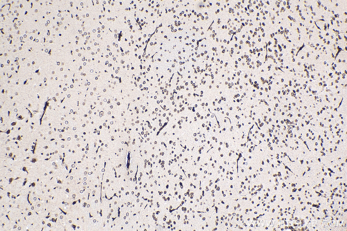 Immunohistochemical analysis of paraffin-embedded mouse brain tissue slide using KHC0317 (TMPO IHC Kit).