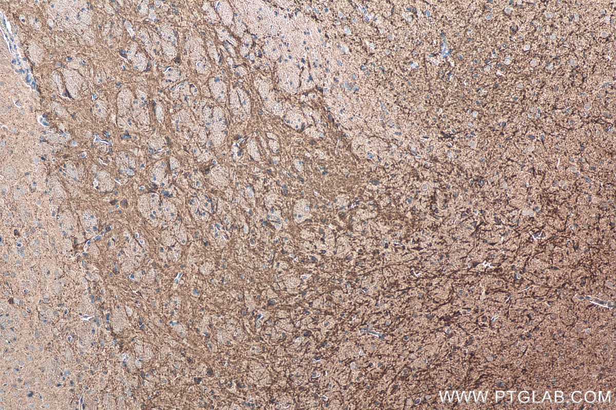 Immunohistochemical analysis of paraffin-embedded rat brain tissue slide using KHC0113 (TNC/Tenascin-C IHC Kit).