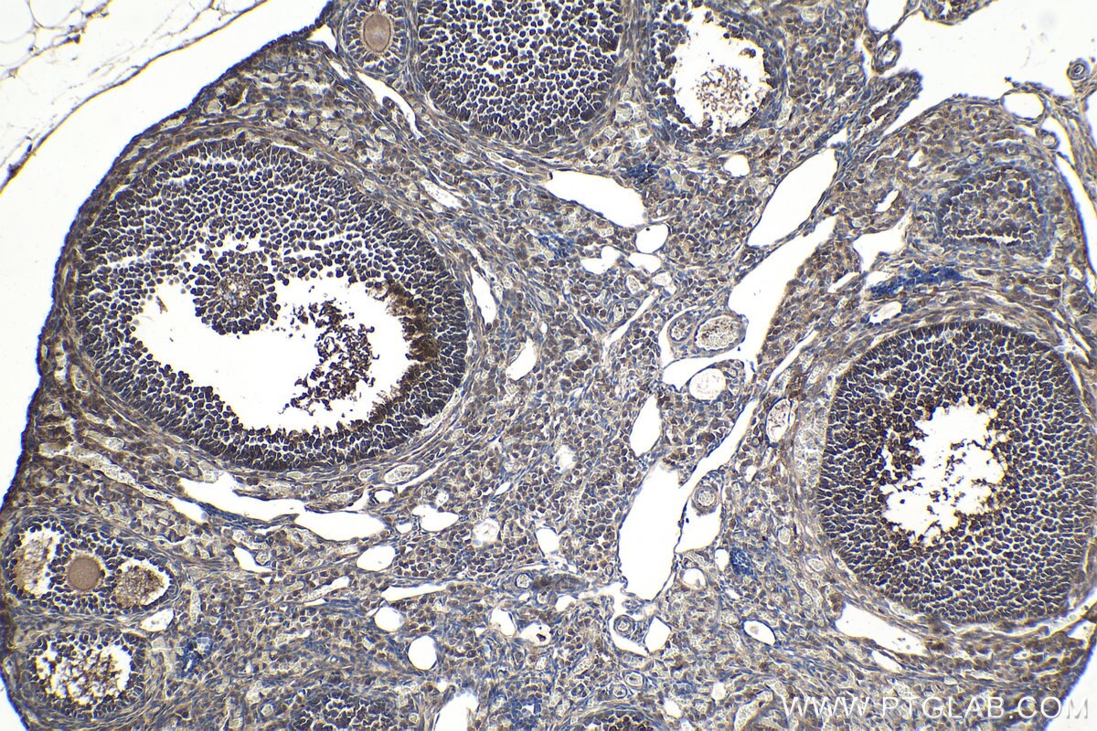 Immunohistochemical analysis of paraffin-embedded mouse ovary tissue slide using KHC1556 (TNFAIP3 IHC Kit).