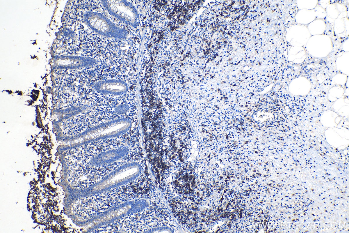 Immunohistochemical analysis of paraffin-embedded human appendicitis tissue slide using KHC1258 (TNFRSF13C IHC Kit).