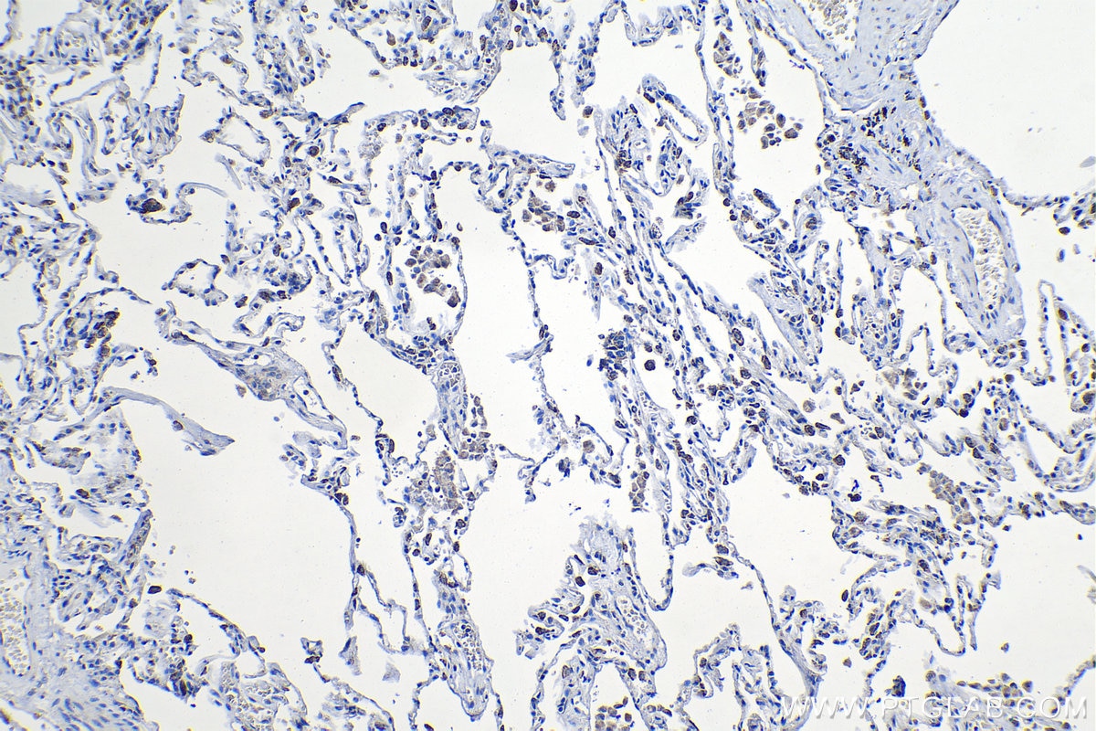 Immunohistochemical analysis of paraffin-embedded human lung tissue slide using KHC1258 (TNFRSF13C IHC Kit).