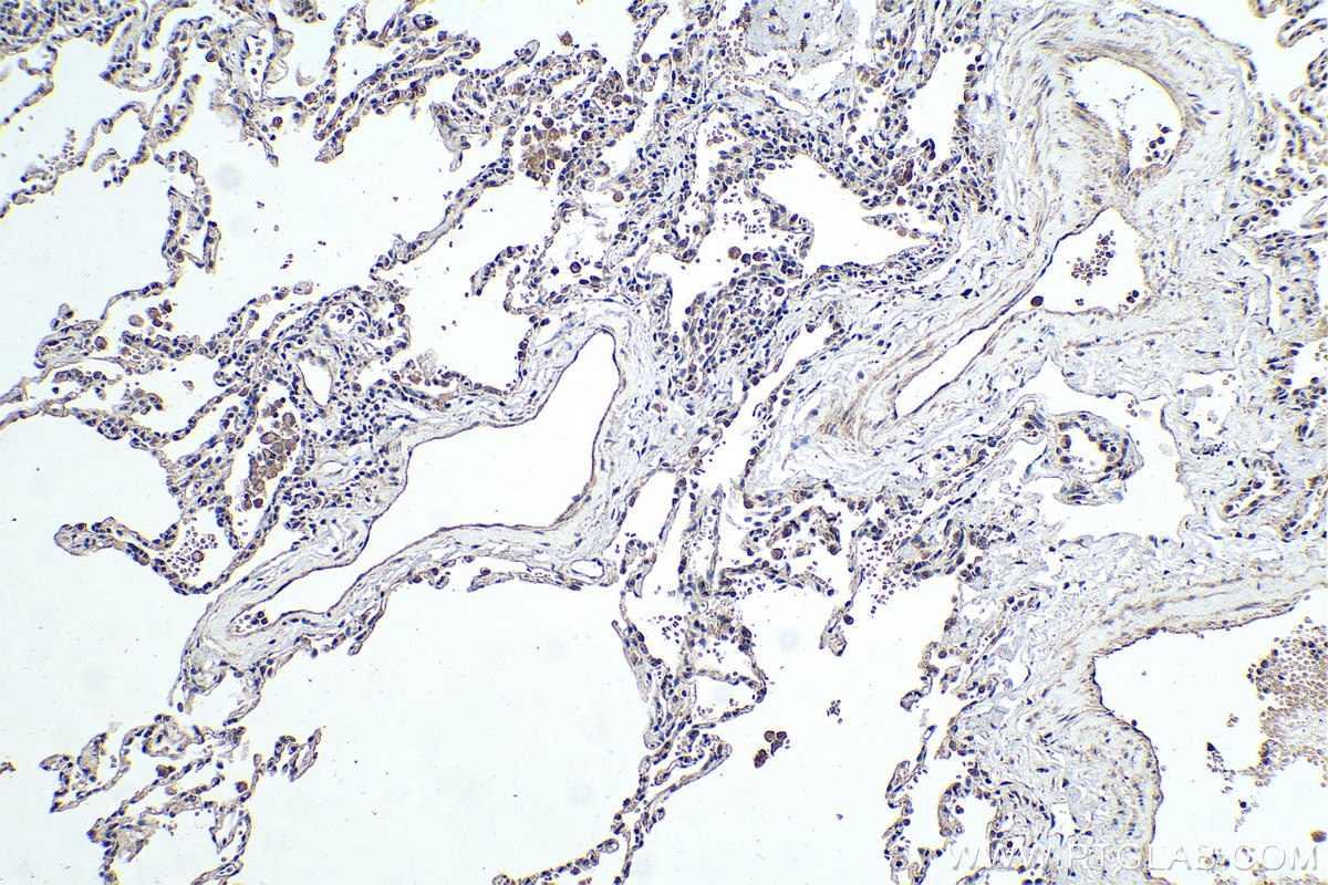 Immunohistochemical analysis of paraffin-embedded human lung tissue slide using KHC0484 (TNFSF14/LIGHT IHC Kit).