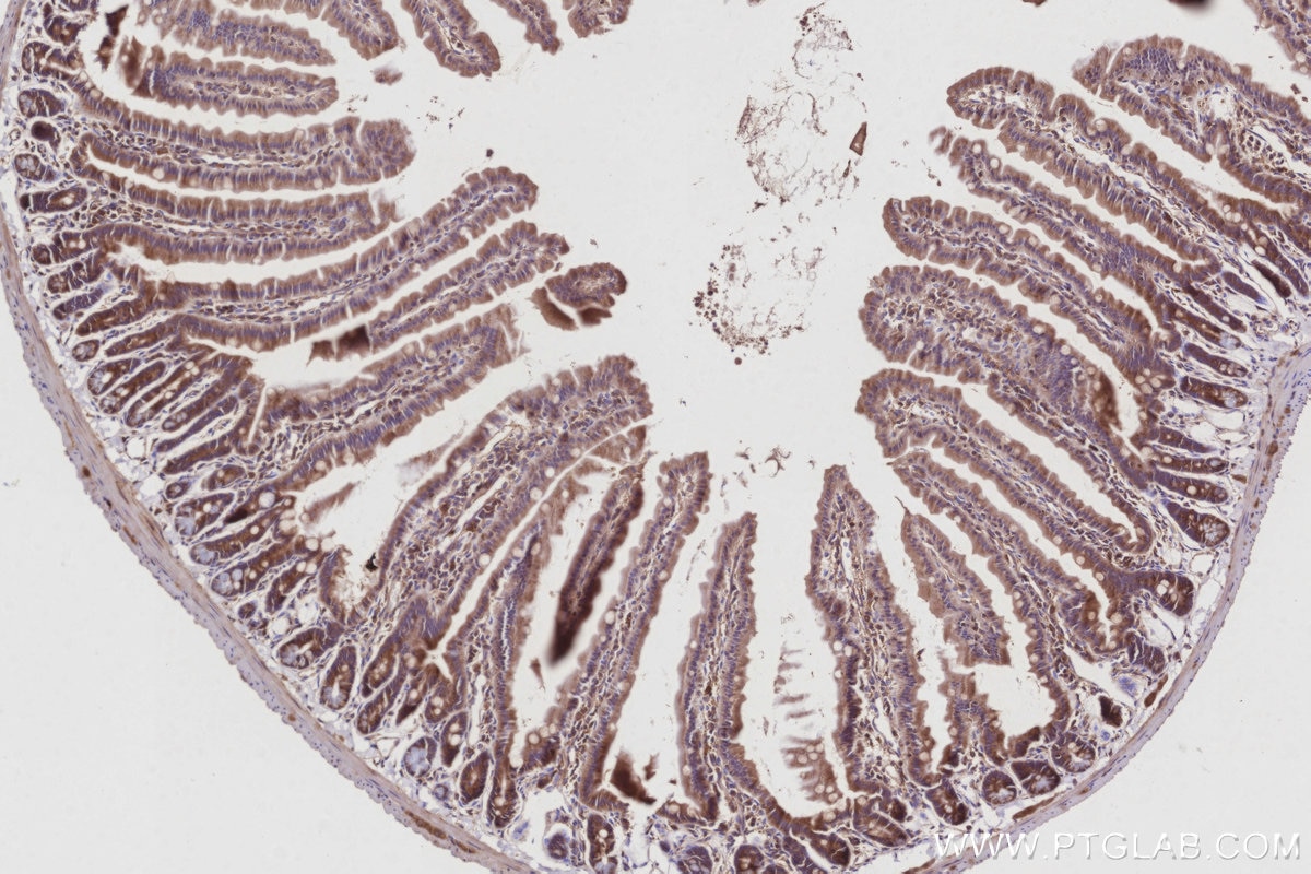 Immunohistochemical analysis of paraffin-embedded mouse small intestine tissue slide using KHC3024 (TNIK IHC Kit).