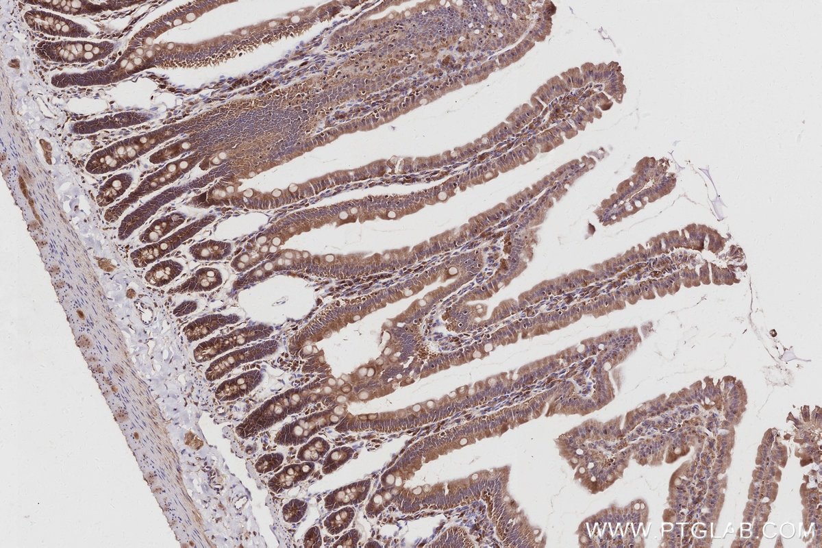 Immunohistochemical analysis of paraffin-embedded rat small intestine tissue slide using KHC3024 (TNIK IHC Kit).