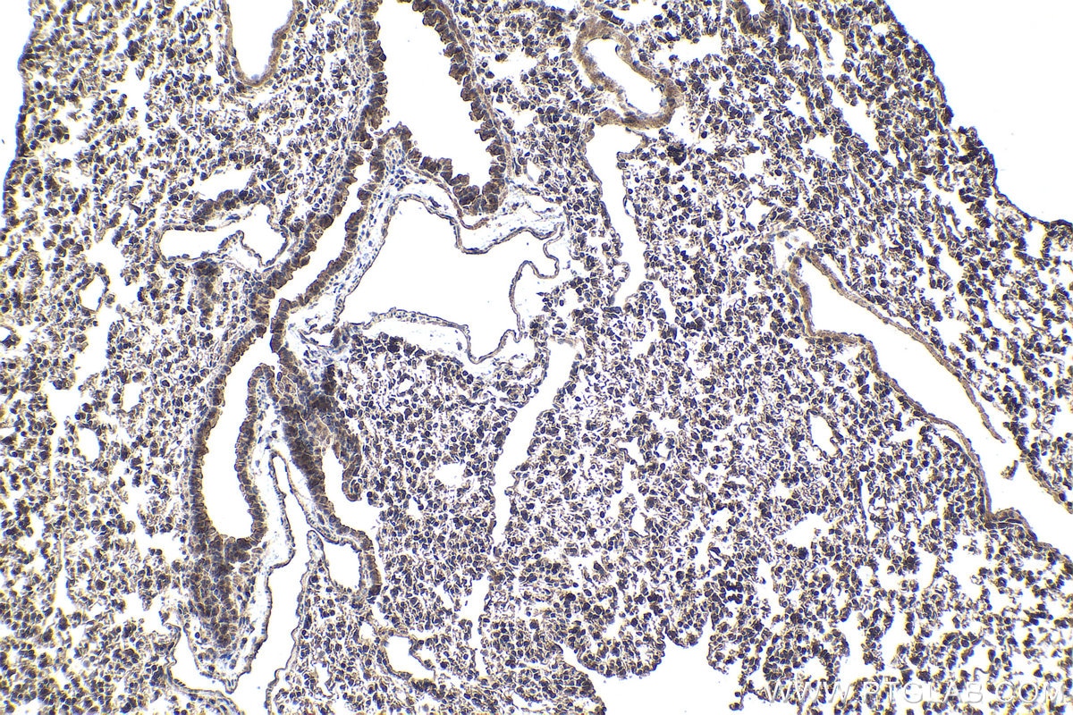 Immunohistochemical analysis of paraffin-embedded mouse lung tissue slide using KHC1747 (TNIP1 IHC Kit).
