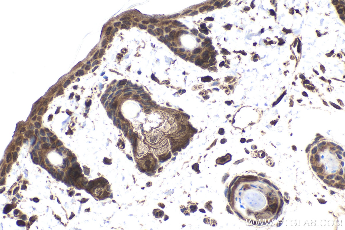 Immunohistochemical analysis of paraffin-embedded rat skin tissue slide using KHC1747 (TNIP1 IHC Kit).