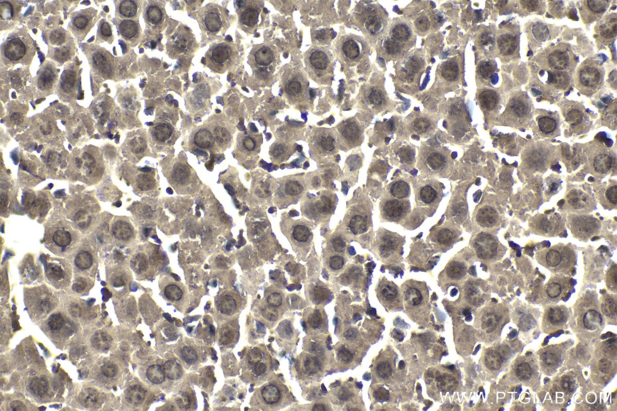 Immunohistochemical analysis of paraffin-embedded mouse liver tissue slide using KHC1840 (TNIP2 IHC Kit).