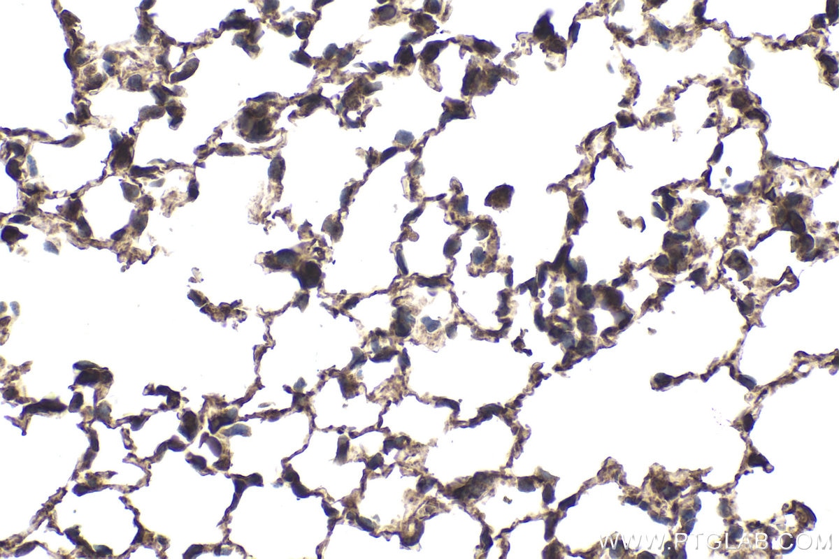 Immunohistochemical analysis of paraffin-embedded mouse lung tissue slide using KHC1840 (TNIP2 IHC Kit).