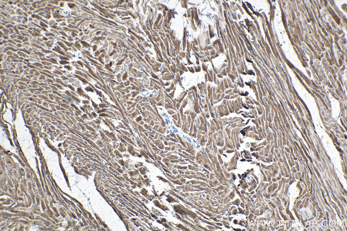 Immunohistochemical analysis of paraffin-embedded rat heart tissue slide using KHC0327 (TNNI3 IHC Kit).