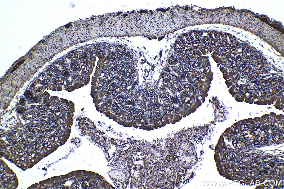 Immunohistochemical analysis of paraffin-embedded mouse colon tissue slide using KHC0972 (TOLLIP IHC Kit).
