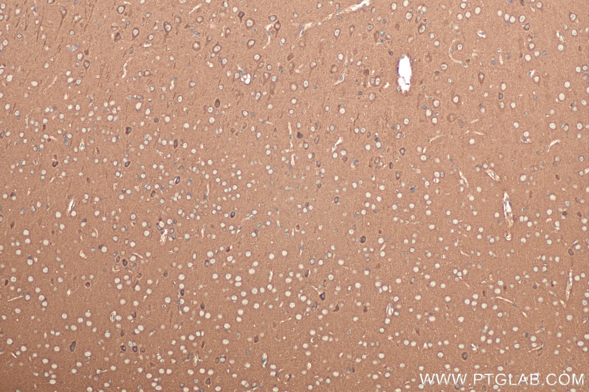 Immunohistochemical analysis of paraffin-embedded mouse brain tissue slide using KHC0972 (TOLLIP IHC Kit).