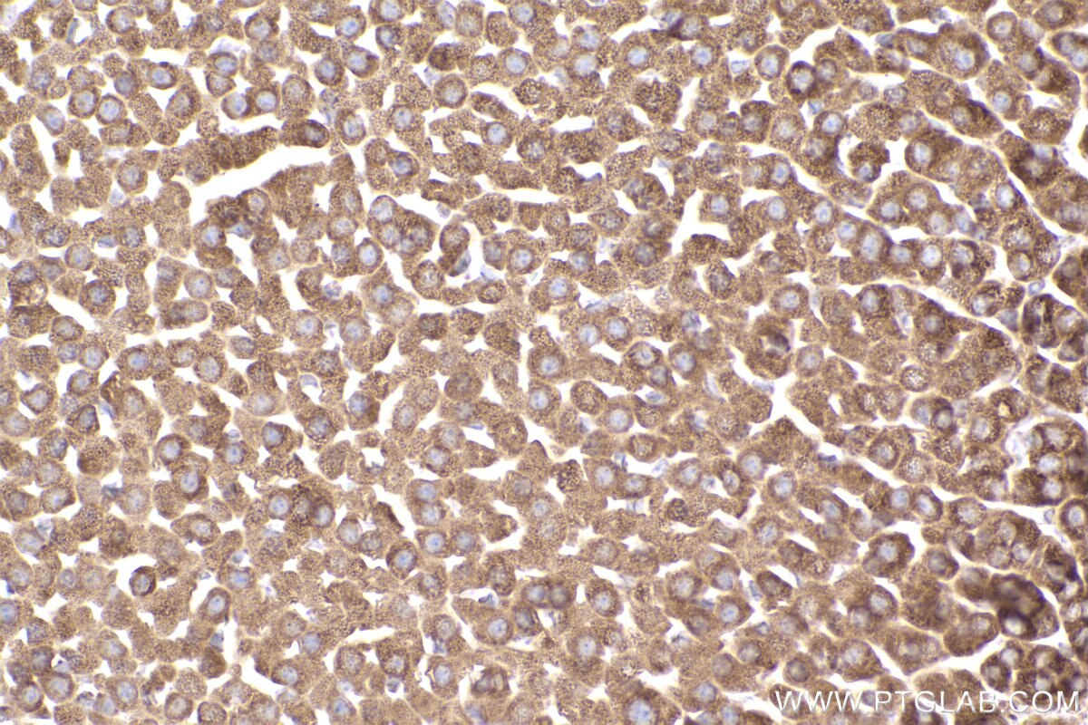 Immunohistochemical analysis of paraffin-embedded mouse adrenal gland tissue slide using KHC2487 (TOMM20 IHC Kit).