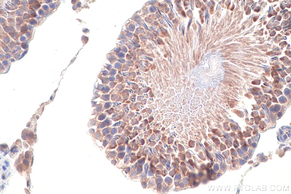 Immunohistochemical analysis of paraffin-embedded rat testis tissue slide using KHC0857 (TOMM34 IHC Kit).