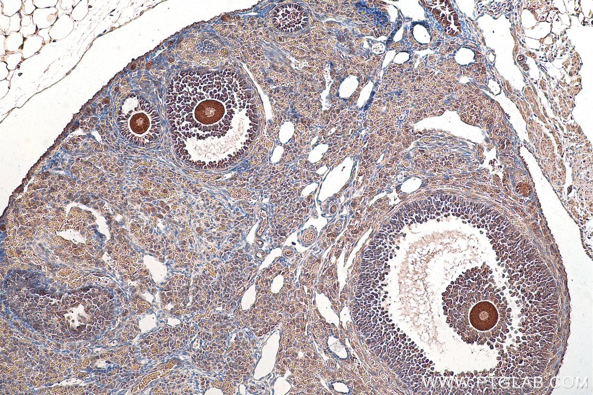 Immunohistochemical analysis of paraffin-embedded mouse ovary tissue slide using KHC0857 (TOMM34 IHC Kit).