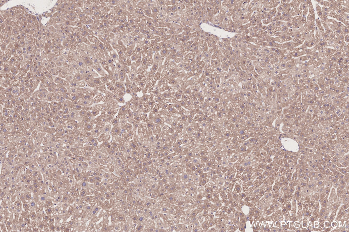 Immunohistochemical analysis of paraffin-embedded mouse liver tissue slide using KHC2697 (TOR1AIP2 IHC Kit).