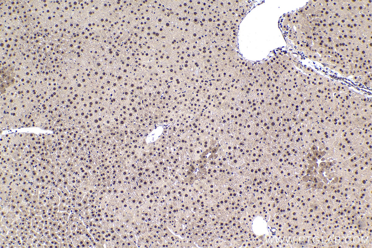 Immunohistochemical analysis of paraffin-embedded mouse liver tissue slide using KHC1483 (TOX4 IHC Kit).