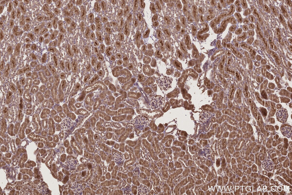 Immunohistochemical analysis of paraffin-embedded mouse kidney tissue slide using KHC2775 (TP53INP1 IHC Kit).
