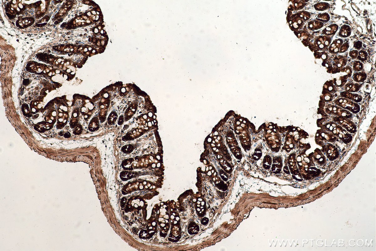 Immunohistochemical analysis of paraffin-embedded mouse colon tissue slide using KHC0844 (TPD52L2 IHC Kit).