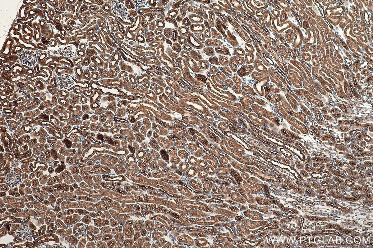 Immunohistochemical analysis of paraffin-embedded mouse kidney tissue slide using KHC0844 (TPD52L2 IHC Kit).