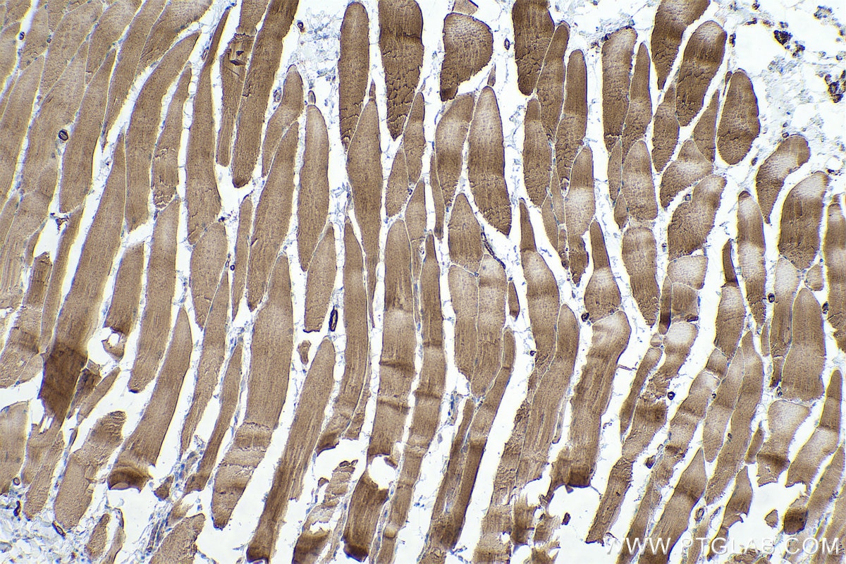 Immunohistochemical analysis of paraffin-embedded rat skeletal muscle tissue slide using KHC0482 (TPM2 IHC Kit).