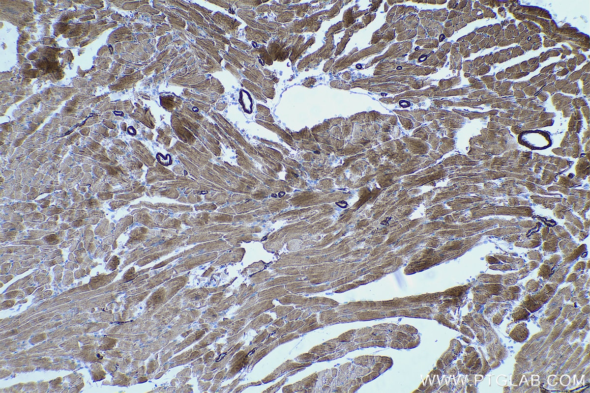 Immunohistochemical analysis of paraffin-embedded mouse heart tissue slide using KHC0482 (TPM2 IHC Kit).