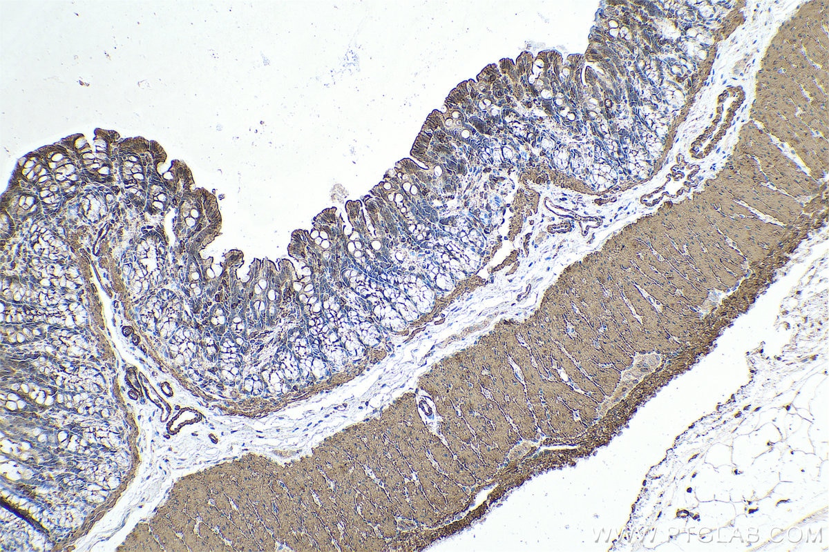 Immunohistochemical analysis of paraffin-embedded rat colon tissue slide using KHC0660 (TPM4 IHC Kit).