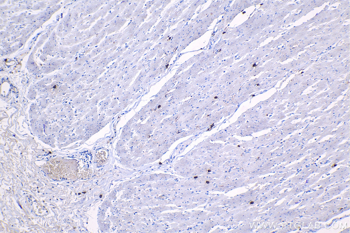 Immunohistochemical analysis of paraffin-embedded human colon tissue slide using KHC1160 (TPSAB1 IHC Kit).