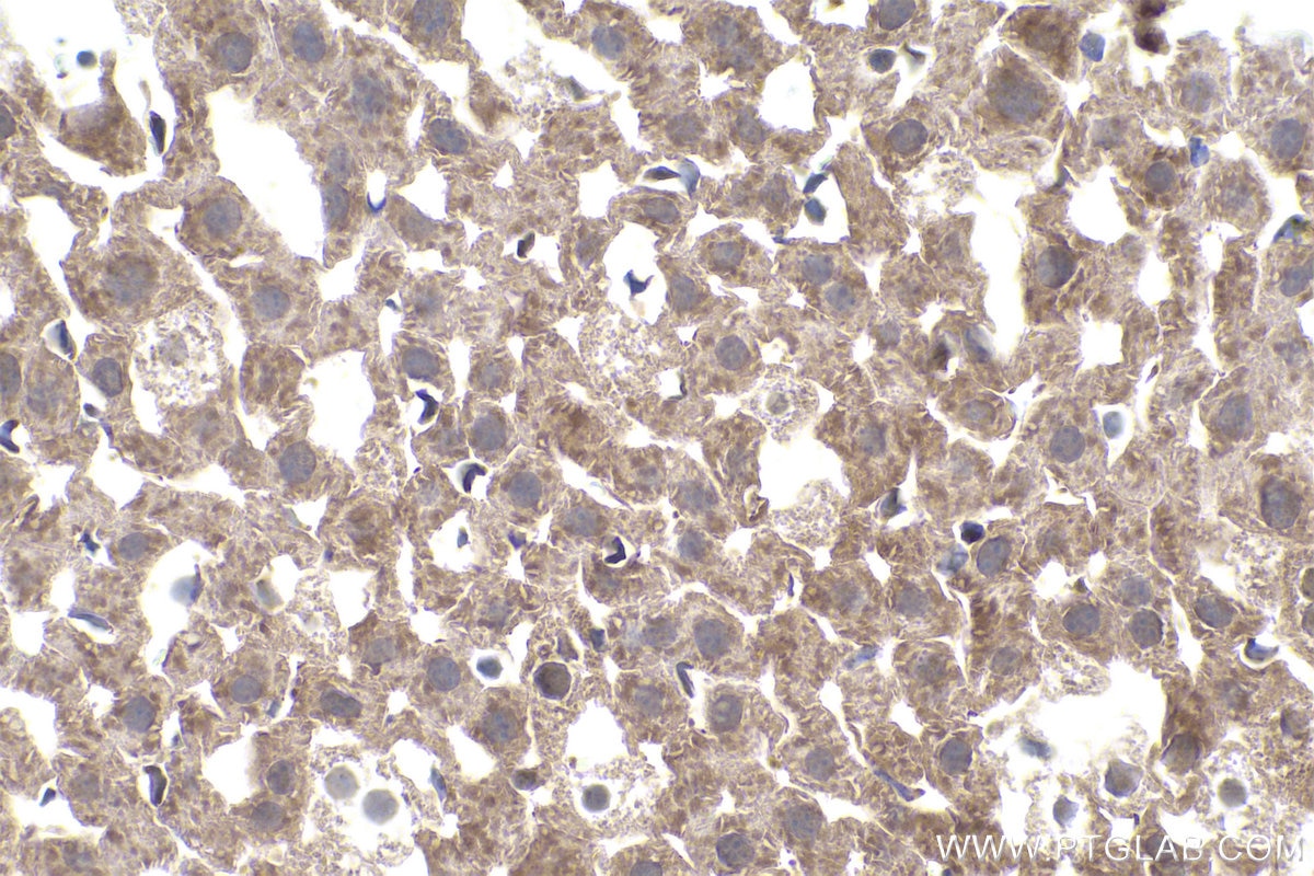 Immunohistochemical analysis of paraffin-embedded mouse liver tissue slide using KHC0874 (TPT1 IHC Kit).