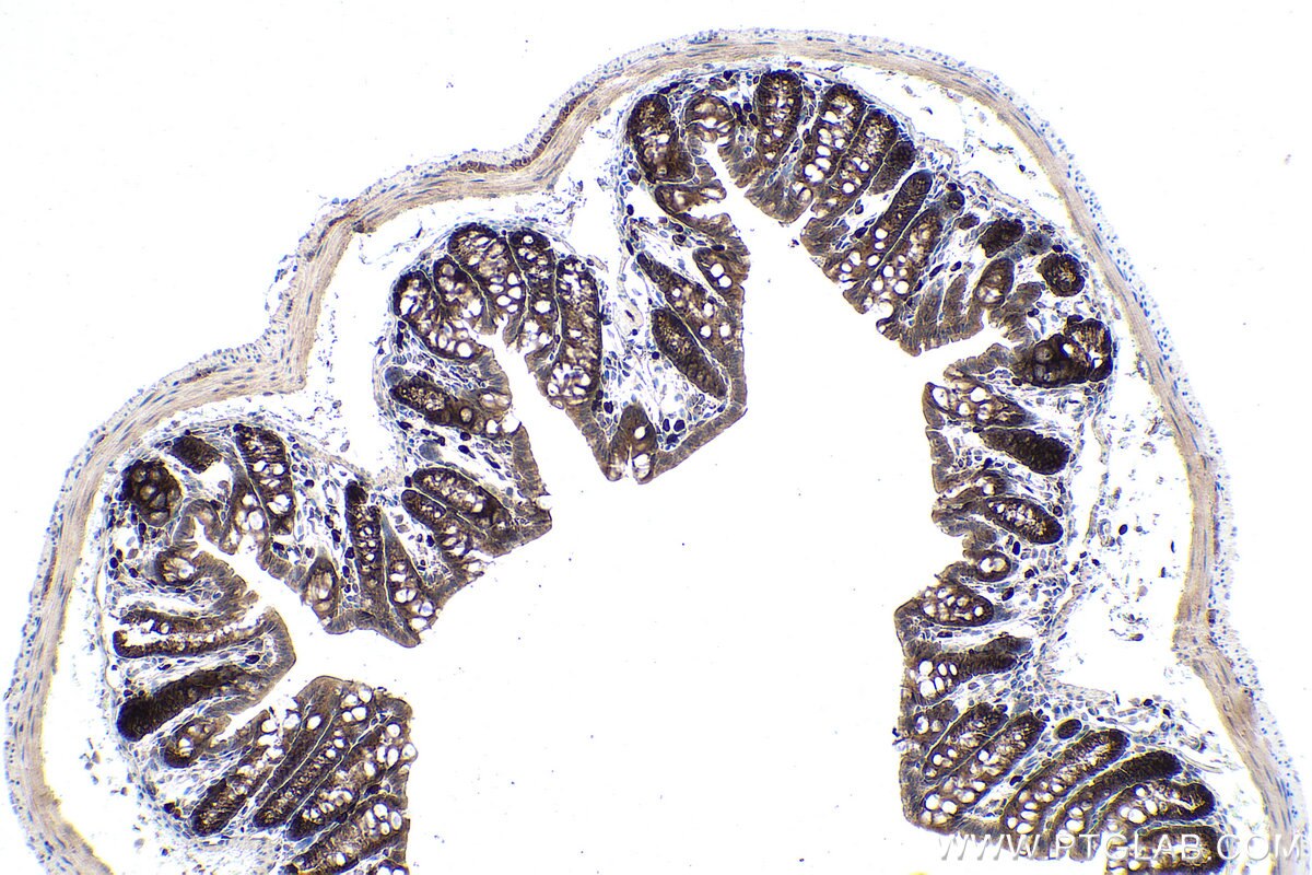 Immunohistochemical analysis of paraffin-embedded mouse colon tissue slide using KHC0874 (TPT1 IHC Kit).