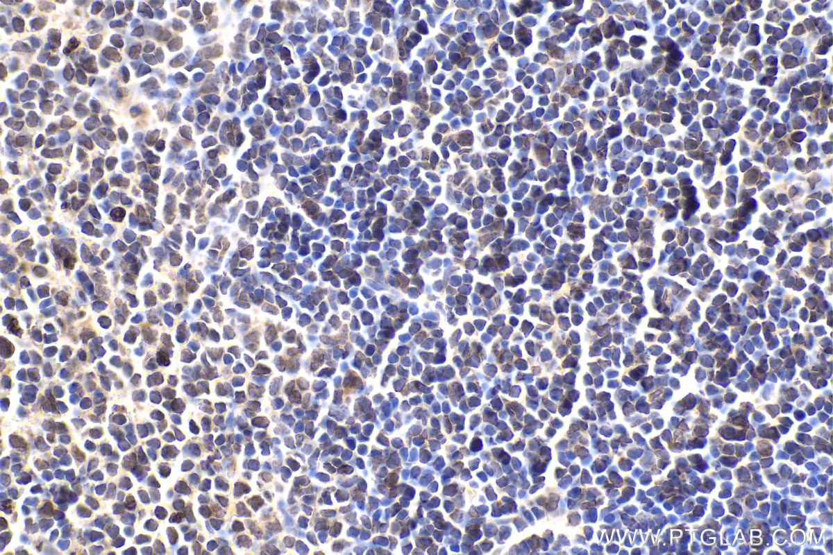 Immunohistochemical analysis of paraffin-embedded mouse spleen tissue slide using KHC1755 (TRADD IHC Kit).